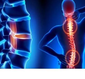 Spinal Injuries and Disorders